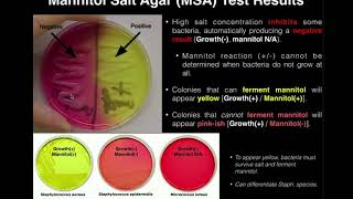 Mannitol Salt Agar MSA  Results amp Theory [upl. by Baynebridge]