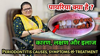 पायरिया क्या है  कारण लक्षण और इलाज । pyriya periodontitis causes symptoms amp treatment [upl. by Afra698]