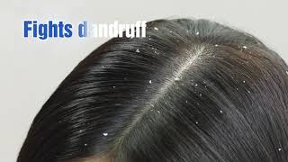 Selsun Blue Professional Dandruff Treatment  Eng [upl. by Rolat519]