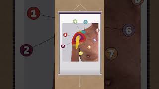 The 12 most common pain locations in the shoulder [upl. by Latimore]