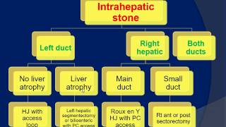 Intrahepatic stones hepatolithiasis [upl. by Laks]