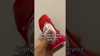 Conaz Shampoo Based Scalp Lotion  Conaz Lotion  Review  Anti Dandruff  Itchy Scalp Treatment [upl. by Atinniuq]