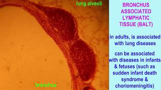 BronchusAssociated Lymphoid Tissue BALT [upl. by Moncear]