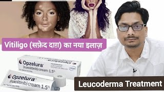 Vitiligo सफ़ेद दाग़ का नया इलाज़ 2024  Vitiligo New Treatment  Ruxolitinib  Leucoderma Treatment [upl. by Lazaruk57]