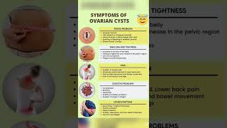 ovarian cyst signs and symptoms [upl. by Donal27]