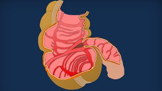 Apparato digerente 12 Intestino crasso  Anatomia macroscopica [upl. by Ainorev]