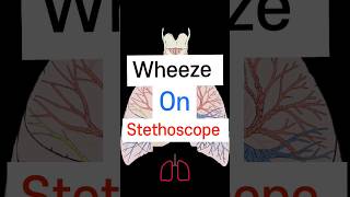 Wheeze on Stethoscope 🩺 Lung sound neetpg fmge medicalstudent [upl. by Lynn]