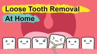 How To Pull Out A Loose Tooth At Home [upl. by Llevad]