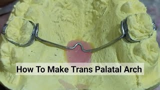 How to Make Transpalatal Arch  TPA orthodontic Appliance By Haider [upl. by Eimak]