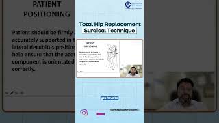 Dr Ashish Taneja Session on Total Hip Replacement Surgical Technique  Orthopedic Residency [upl. by Llenoj]