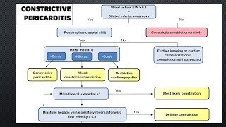 Constrictive Pericarditis signs in a case [upl. by Kashden]