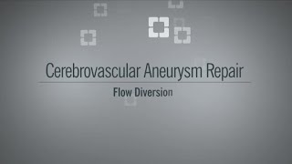 Aneurysm Flow Diversion [upl. by Llehsor]