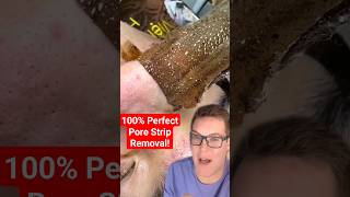 😍 Perfect PORE STRIP REMOVAL shorts [upl. by Nonaihr]