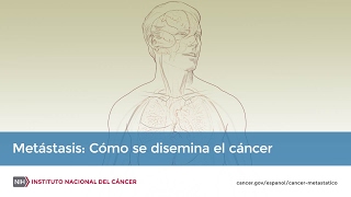 Metástasis Cómo se disemina el cáncer [upl. by Yasnil]