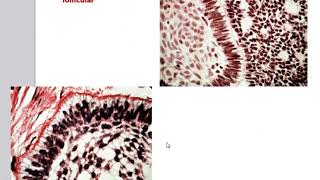 Odontogenic Tumors [upl. by Annabal976]