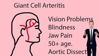 Arteritis  Causes Symptoms Treatment Types [upl. by Aicinoid442]