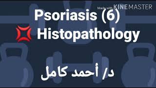 6 Psoriasis 👉 Histopathology [upl. by Odlopoel]