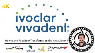 How is the FaceBow Transferred to the Articulator   Yüz Arkı kaydı Artikülatöre Nasıl Aktarılır [upl. by Dallas]