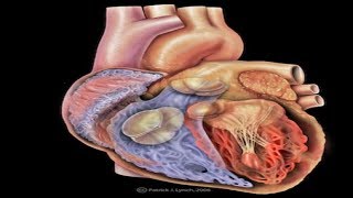 Angiogram and Angioplasty live Video  Coronary angiogram full length procedure MST RASHIDA BEGUM [upl. by Aizahs]