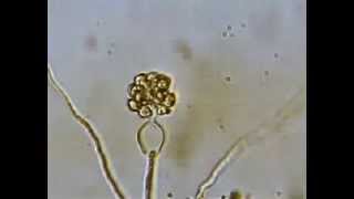 Release of Zoospores by Pythium [upl. by Torto]