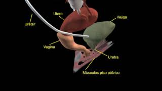 Incontinencia Urinaria Mixta  Visualización anatómica en 3D [upl. by Ordep]