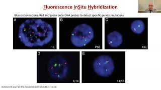 Using Daratumumab to Treat HighRisk Myeloma Patients [upl. by Fanny]