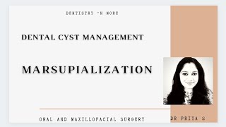 MARSUPIALIZATION MANAGEMENT OF ODONTOGENIC CYST PART 1Dr Priya [upl. by Netsriik]