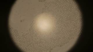 Yeast cells under the microscope [upl. by Rabkin619]