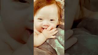 ❤️Down Syndrome Cute Moments shorts downsyndrome [upl. by Laehctim]