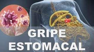 ☞ Secretos caseros para la gastroenteritis o gripe estomacal–Como reducir la gastroenteritis en casa [upl. by Hahnke]