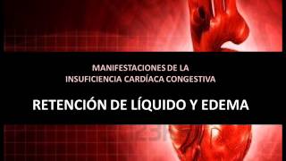 Insuficiencia cardíaca congestiva  Edema y retención de líquido [upl. by Stormy]