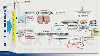 REUMATOLOGÍA MONOARTRITIS [upl. by Lexy]