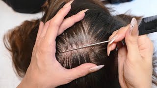 ASMR Intense Scalp SCRATCHING and NITPICKING with Nails Real Person [upl. by Drazze372]