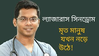 lazarus Syndromeমৃত মানুষ যখন নড়ে উঠে। Dr Saklayen Russel [upl. by Orbadiah327]