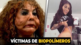 10 Famosas víctimas de los biopolímeros [upl. by Sidney516]