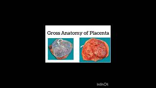 Gross Anatomy of Placenta shorts shortvideo [upl. by Corrina884]