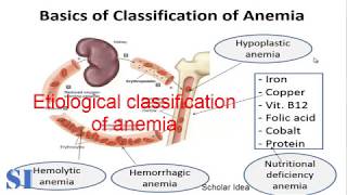 Types of anemia أنواع الأنيميا [upl. by Anaoy]