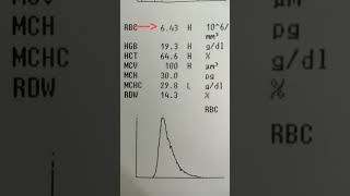 A patient with high Hemoglobin High RBC count High HctPCV High MCV  What is diagnosis [upl. by Sihtnyc]