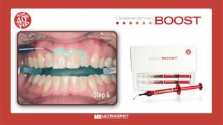 Ultradent Opalescence Boost Whitening [upl. by Ro]