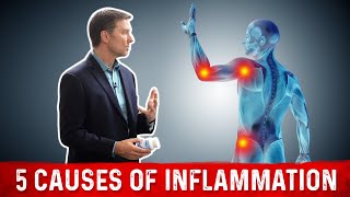 Stop the 5 Causes of Inflammation FAST – Dr Berg [upl. by Eta207]