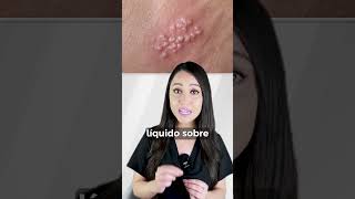 ¿Mito o realidad👩🏻‍⚕️ herpes salud medicina [upl. by Normalie668]