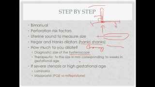 dilation and curettage  description indications and questions [upl. by Nette142]