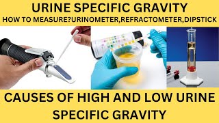 URINE SPECIFIC GRAVITYHOW TO MEASURECAUSES OF HIGH AND LOW SPECIFIC GRAVITYURINE ROUTINE [upl. by Eniale]