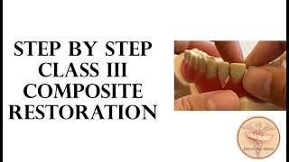 STEP BY STEP  Class III composite restoration [upl. by Mikeb]