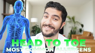 MOST COMMON Allergens Causing Your Itch [upl. by Yenolem453]