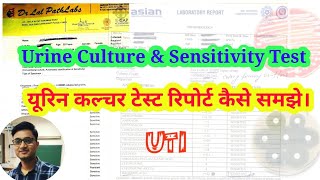 Urine Culture Test in Hindi  How to Read Urine Culture Test Report [upl. by Karney]