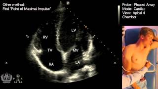 Apical 4 Chamber View on Transthoracic Echocardiography Cardiac Ultrasound [upl. by Bille36]