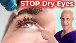 Soothe and Heal DRY EYES Naturally Dr Mandell [upl. by Nilyak]