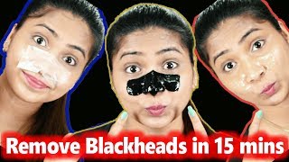 3 DIY Pore Strips to get rid of BLACKHEADS WHITEHEADS Instantly amp Naturally at Home RABIA SKIN CARE [upl. by Azarcon]