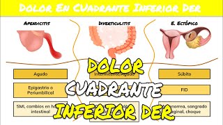 ⚕️🩺 DOLOR EN LADO DERECHO DEL ABDOMEN  Apendicitis o Diverticulitis o Embarazo Ectópico [upl. by Shimkus]